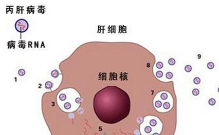 丙肝治愈能做试管婴儿吗?